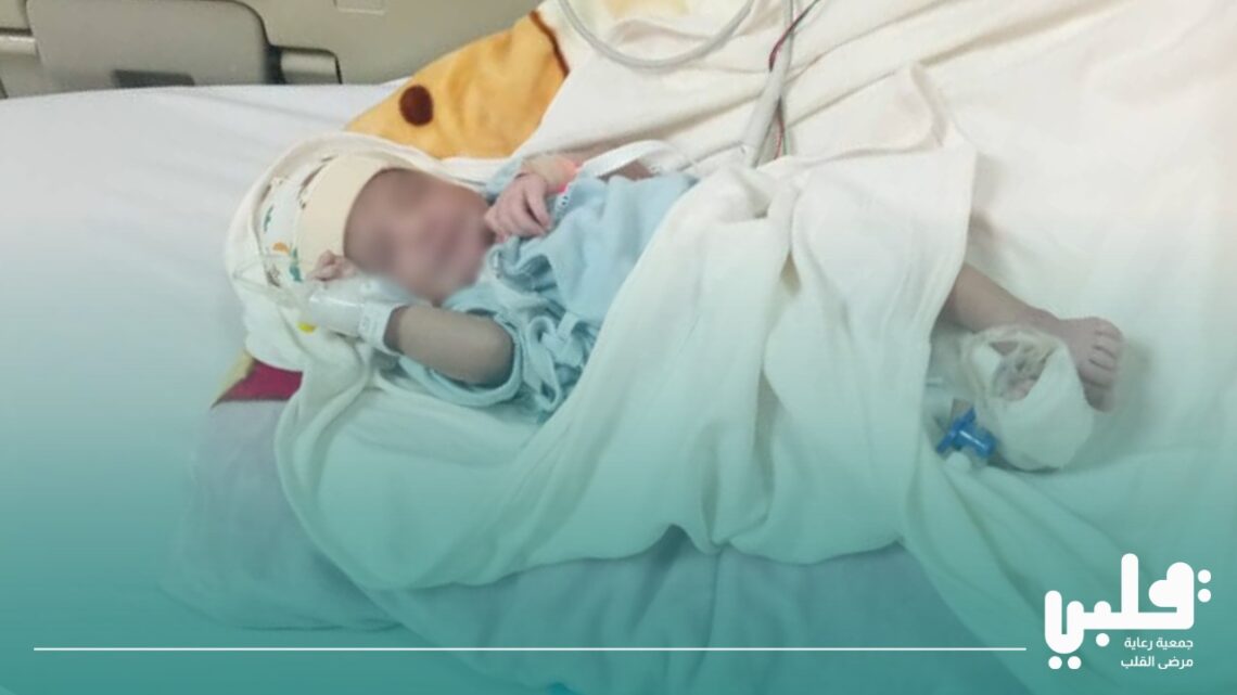 جمعية “قلبي” تنقذ طفلاً رضيعاً بعمر يومين في عملية طوارئ عاجلة